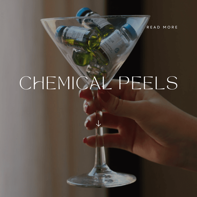 Custom Chemical Peel pkg of 3 