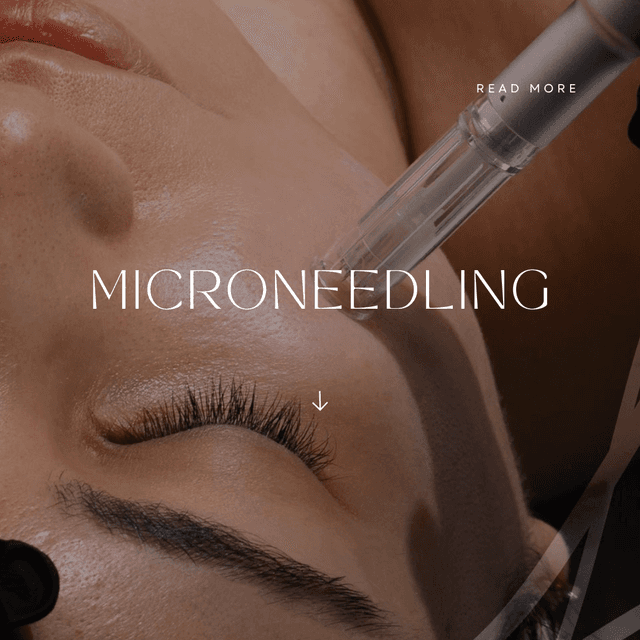 Microneedling Face pkg of 3 