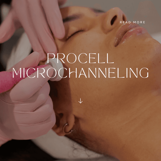 Procell Microchanneling Face pkg 3 